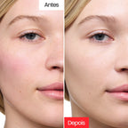 Creme Corretivo - Centella Cream™